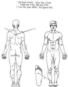 Воздействие на акупунктурные точки при лечении псориаза